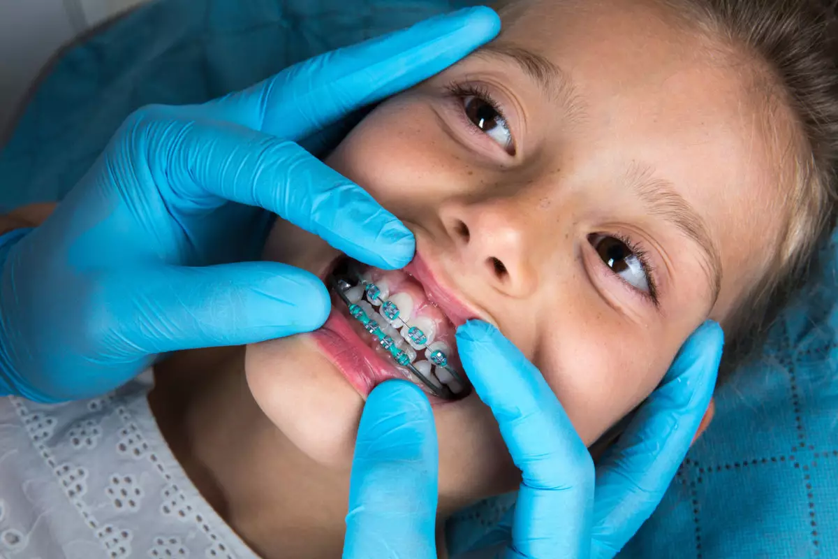 طب اسنان الاطفال